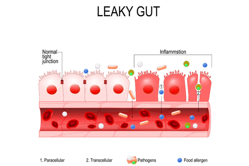 Skillnaden mellan en normal tarm och en tarm med inflammation 